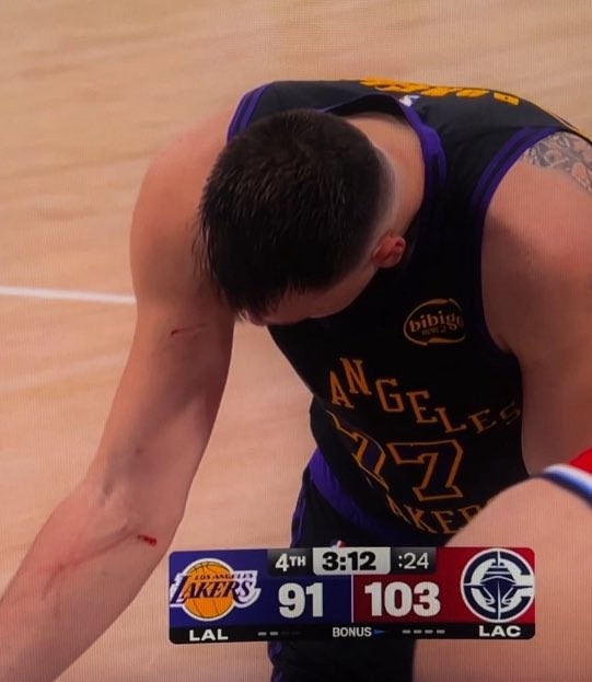 星空体育在线入口-谁抓的~东契奇罚球时看向手臂 好几道伤口&amp;血迹斑斑